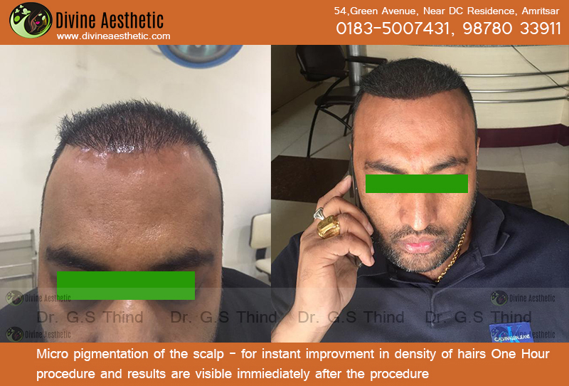 Micro-pigmentation-in-amritsar-divine-photo-template