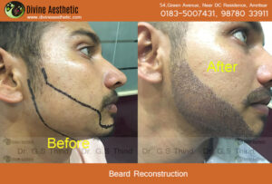 beard-reconstruction-231