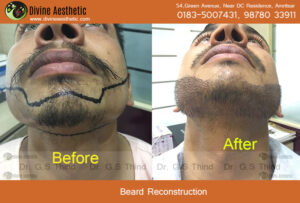 beard-reconstruction-233