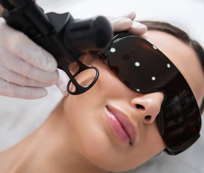 Fractional CO2 Laser Treatment