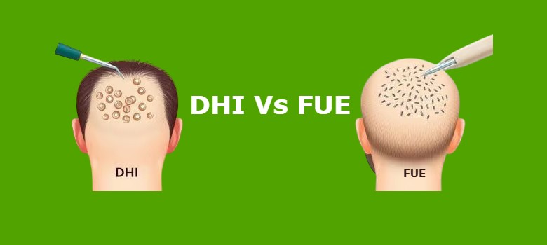 dhi vs fue hair transplant